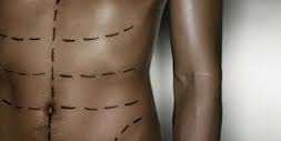 Est-ce qu'une abdominoplastie et la liposuccion peuvent être effectuées simultanément?